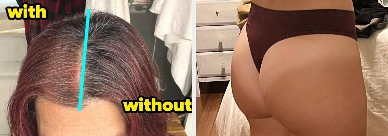 41 Products If You Wish Those Slightly Embarrassing Problems Would Just… Disappear