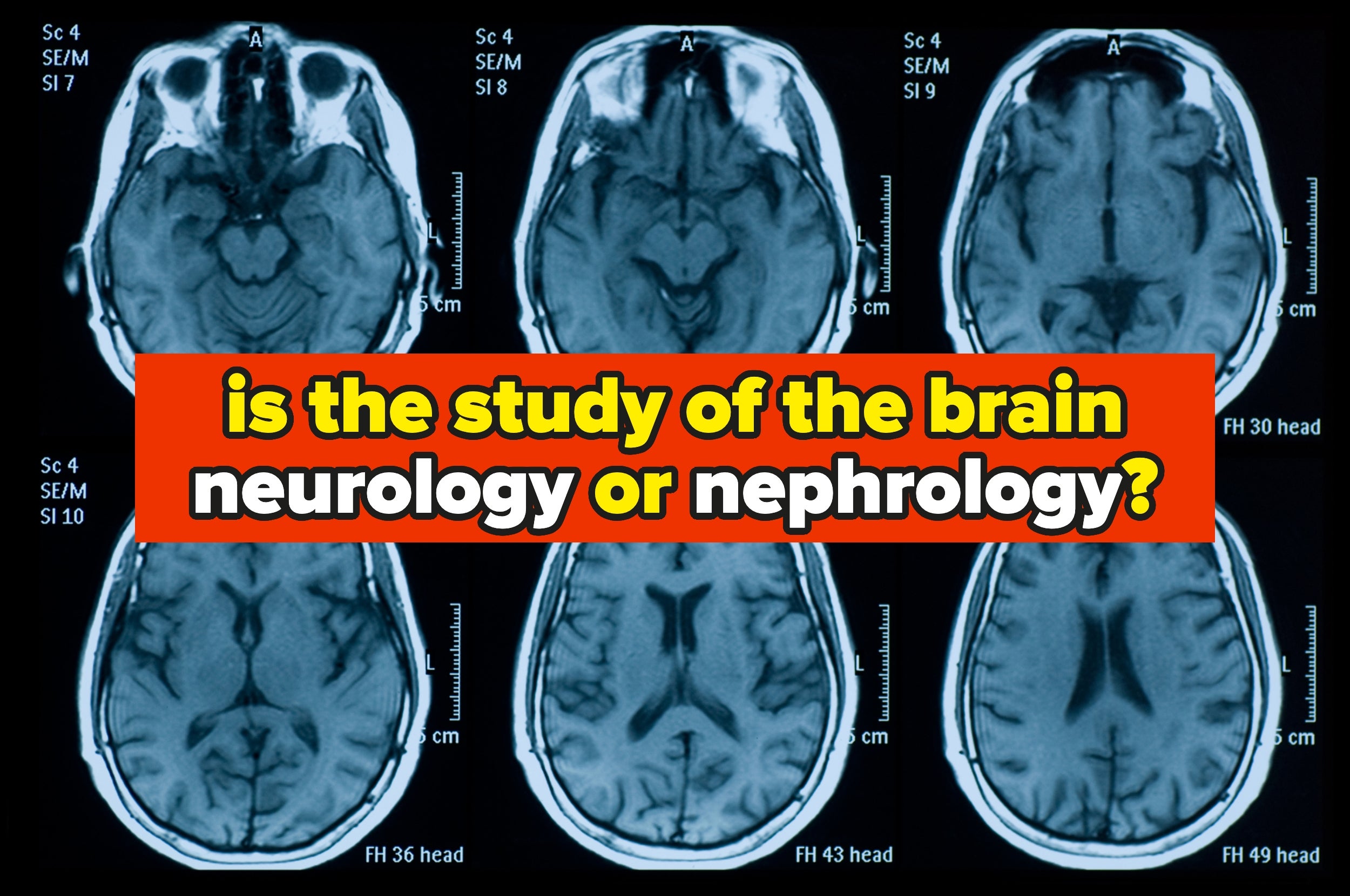 Four MRI brain scans with text questioning if brain study is neurology or nephrology