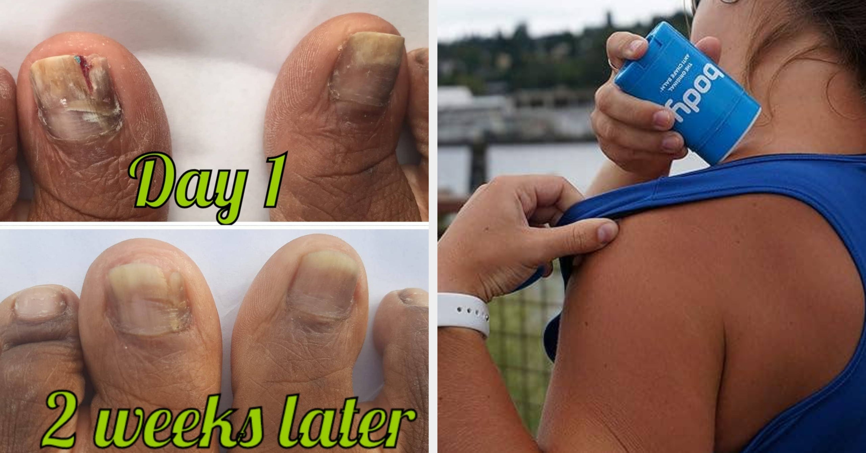 Just 33 Products For Those Body Things You'd Rather Google T