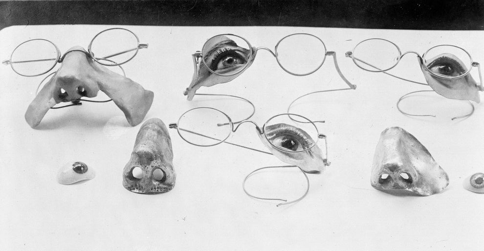 Assorted prosthetic eyes, noses, and eyeglasses displayed on a surface, showcasing historical medical advancements