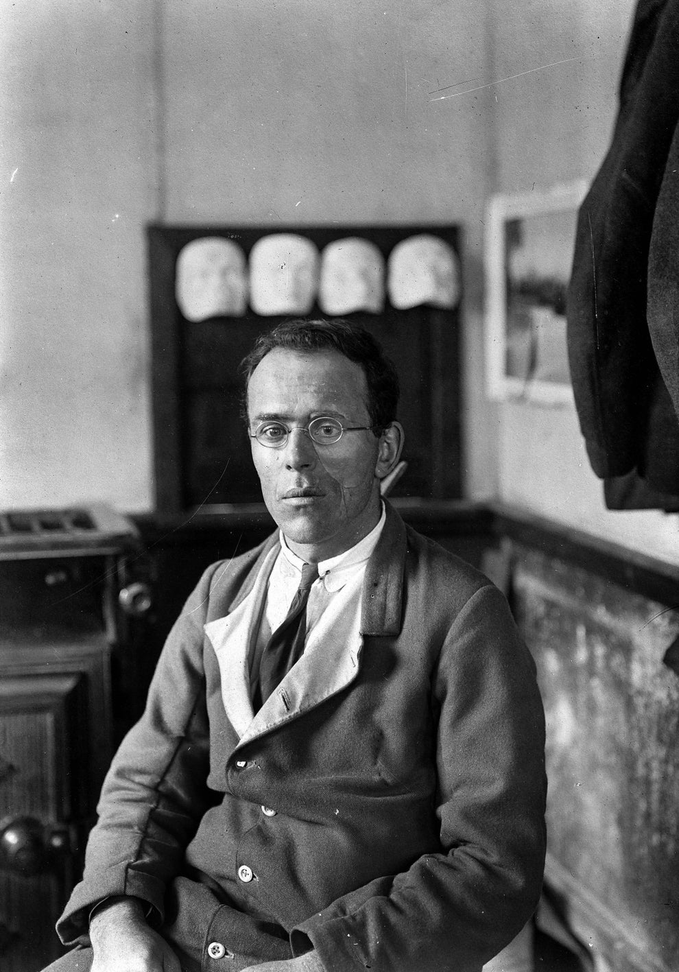 A person in early 20th-century attire, wearing glasses and a two-tone jacket, is seated in a room with x-rays on the wall behind
