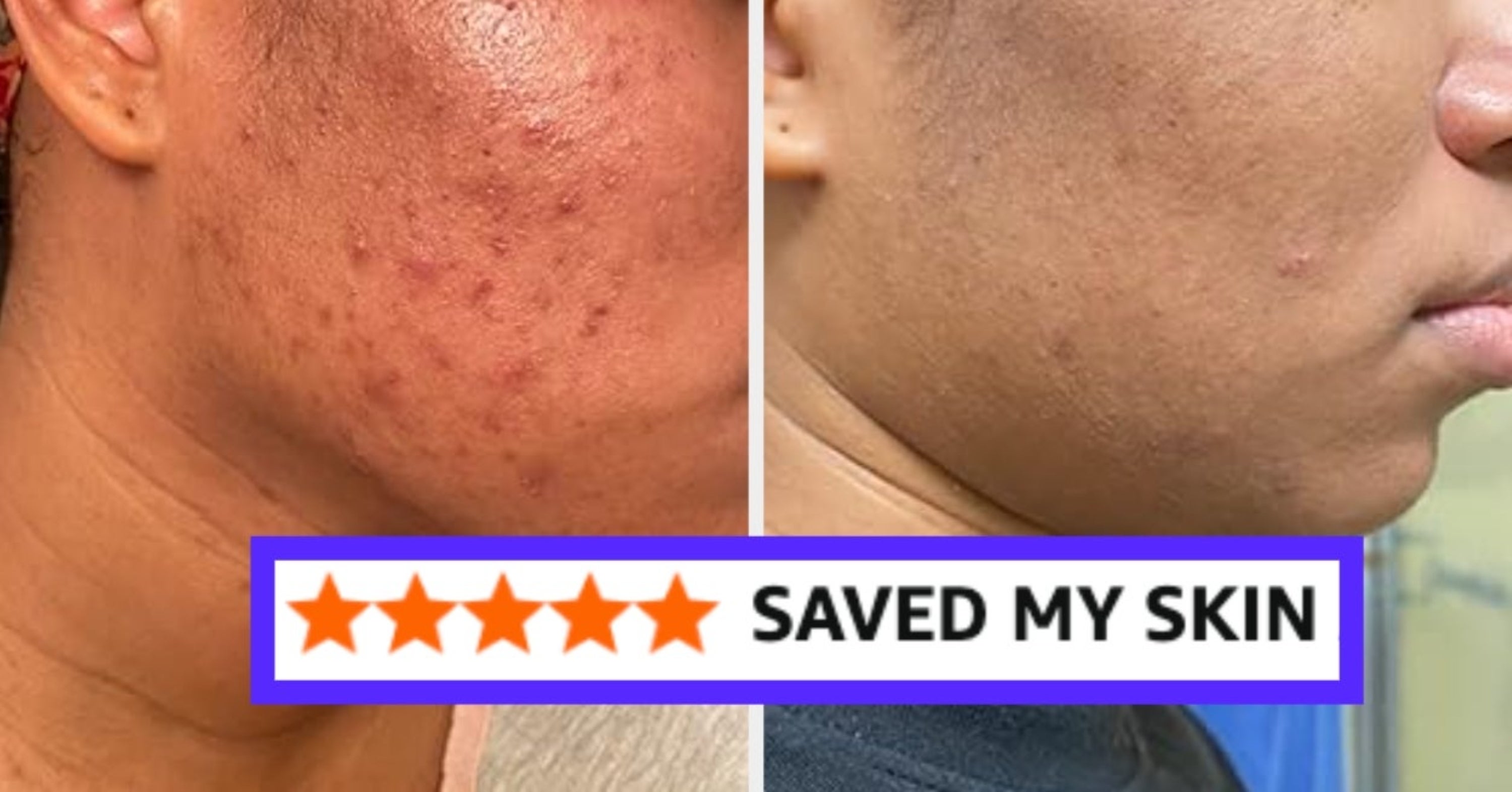 Reviewers Call These 32 Beauty Products A “Miracle” And You’re About To Become Their Newest Believer