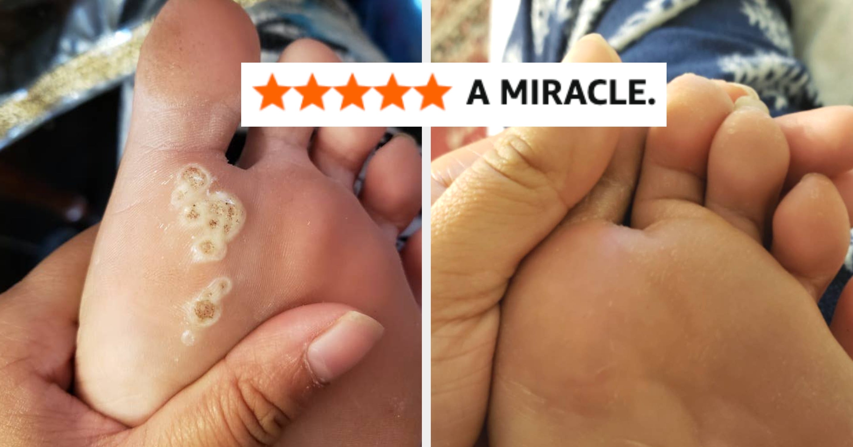28 Products With Such Riveting Results, You’ll Question Why You Waited So Long To Buy Them