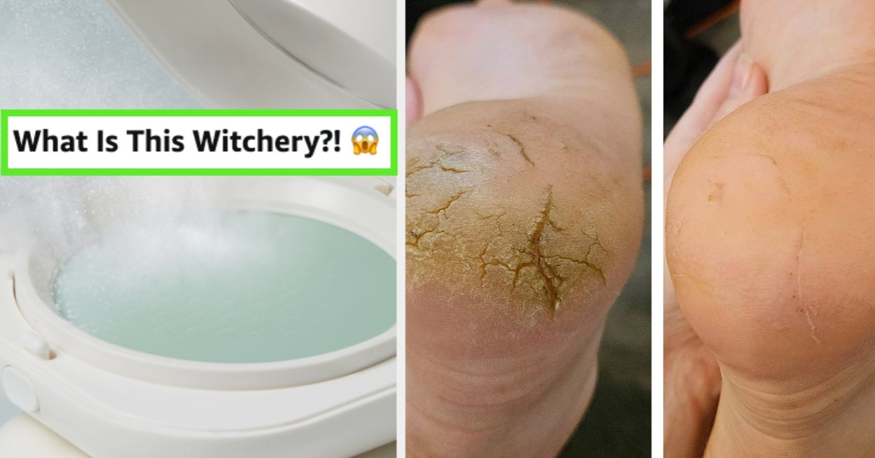 36 Beauty Items With Such Jaw-Dropping Results, You’ll Be Fully Convinced A Witch Invented Them