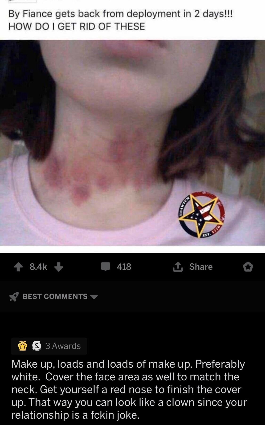 A idiosyncratic   with hickeys connected  their neck, asking online for proposal  connected  covering them earlier  their fiancé returns from deployment