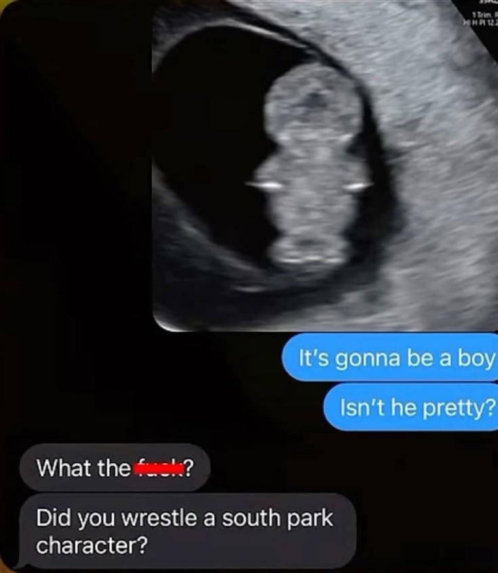 Ultrasound representation  with substance   overlay. One idiosyncratic   states it's a boy; different  humorously questions if the babe  resembles a South Park character