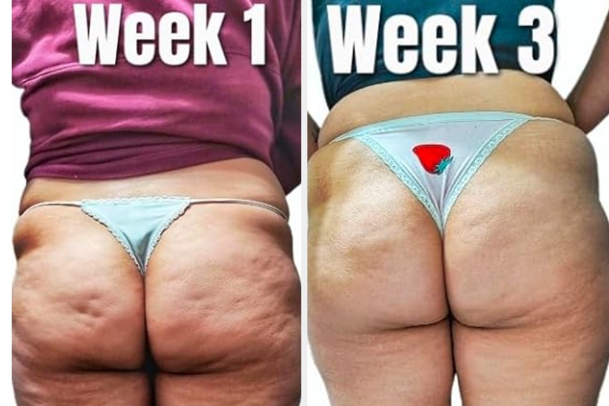 Get Some Relief From Those Downright Diabolical Body-Related Aggravations With These 37 Products
