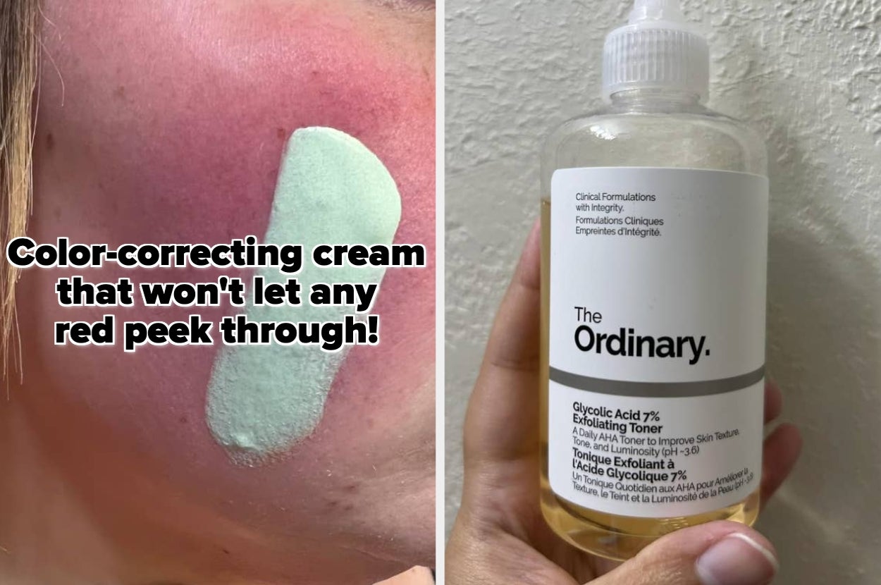 A person applies color-correcting cream to red skin. A hand holds The Ordinary Glycolic Acid 7% Exfoliating Toner bottle
