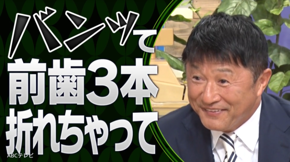 5OGKb6BL1.png