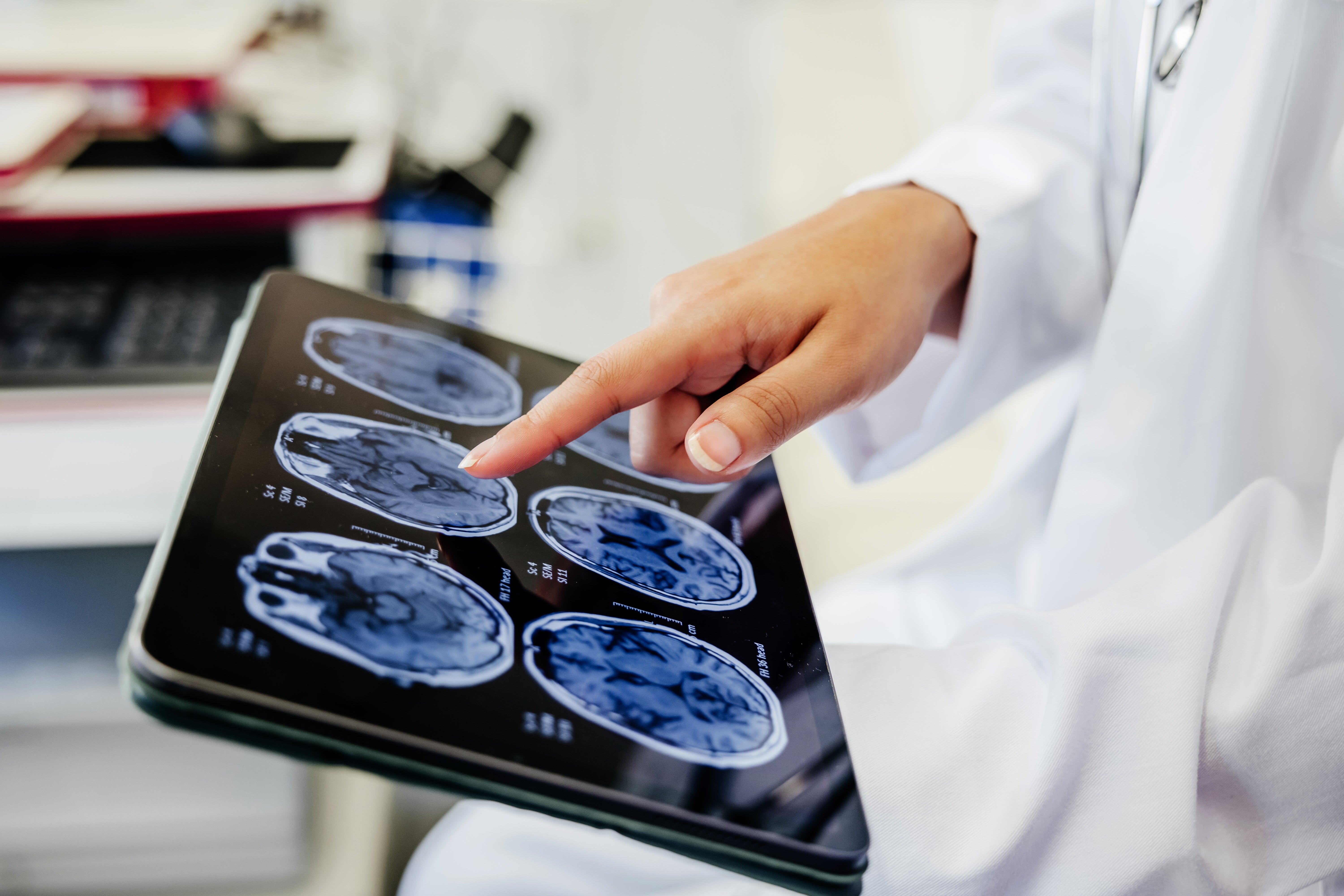 A healthcare nonrecreational examines encephalon scan images connected a tablet, focusing connected diagnostic information