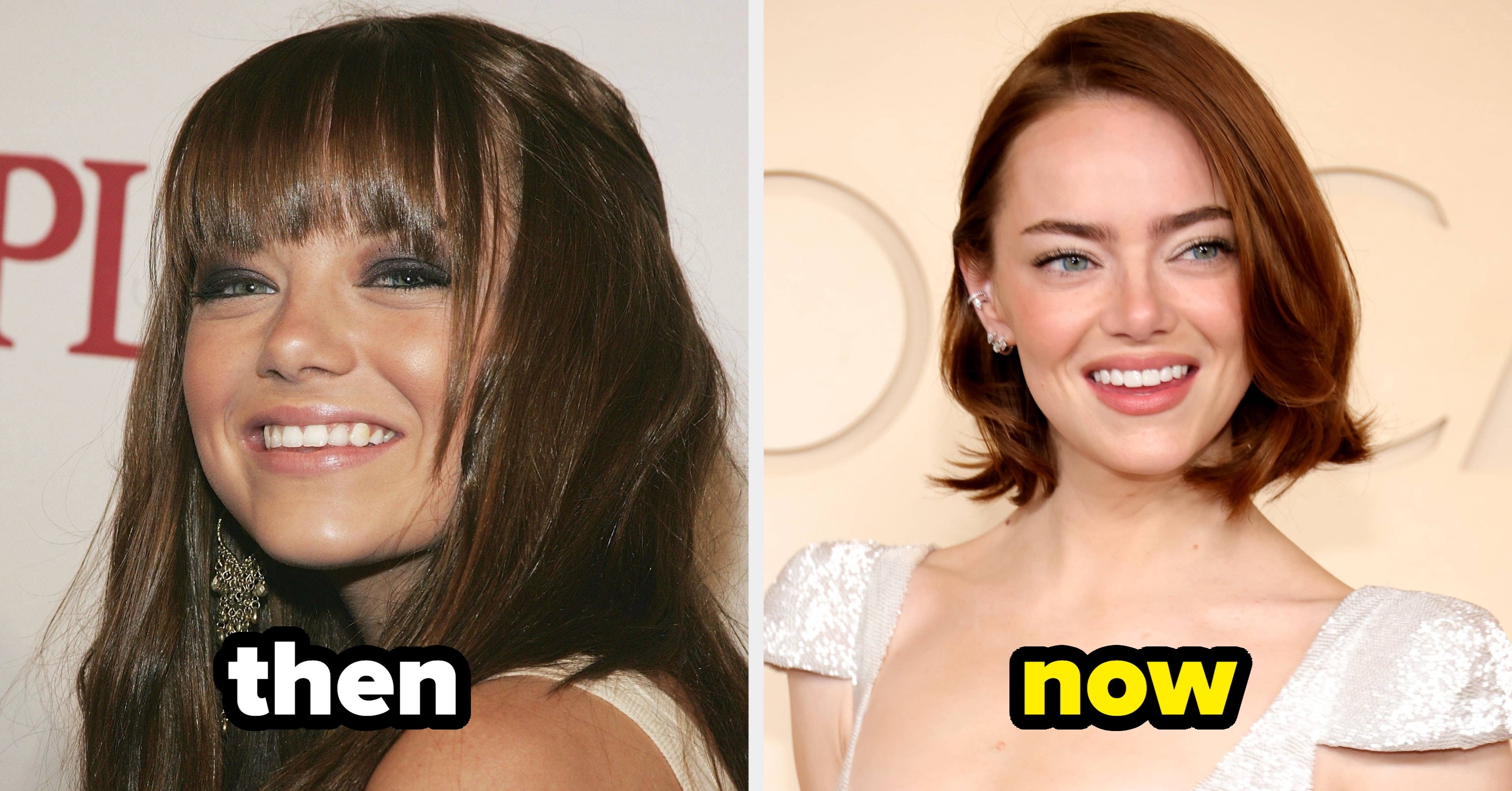 Here's What Kylie Jenner, Zac Efron, And 22 More Celebs Looked Like Before Getting Super Famous
