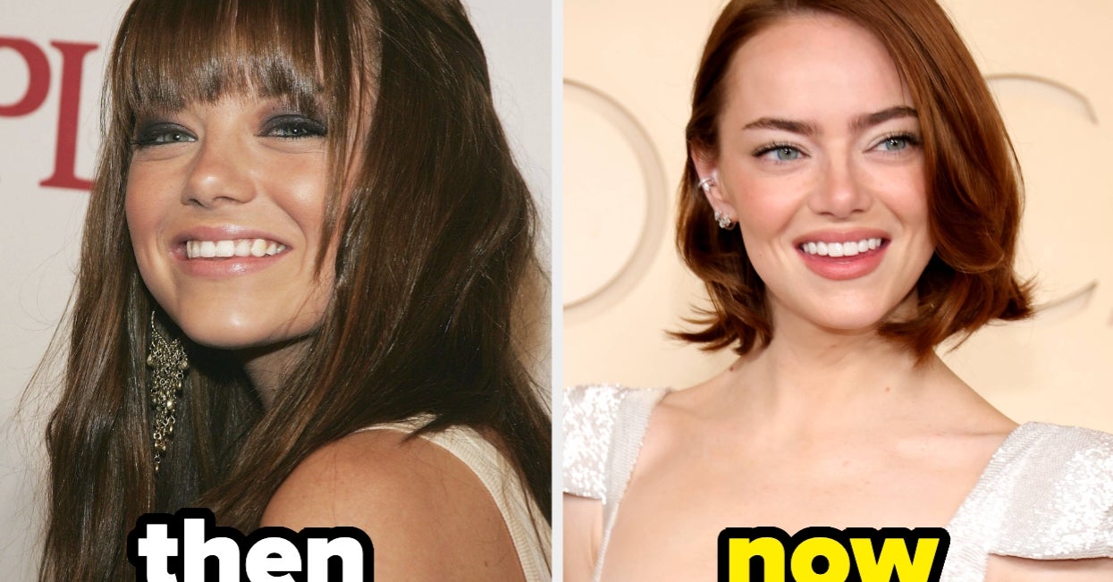 24 Celebrity Faces Before And After Fame That’ll Instantly Make You Do A Double Take - BuzzFeed image