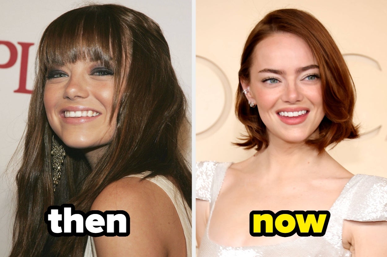 24 Celebrity Faces Before And After Fame That'll Instantly Make You Do A Double Take