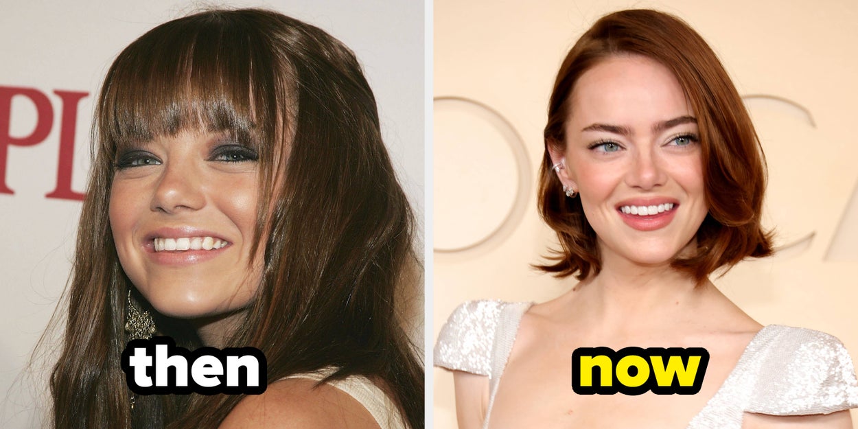 Celebrities Before And After Fame