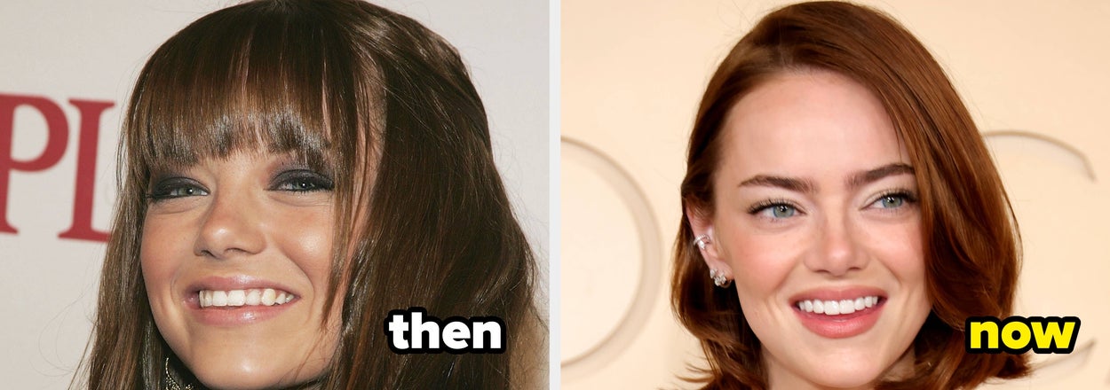 I Can't Believe How Different These Celebs Looked Before They Got Famous