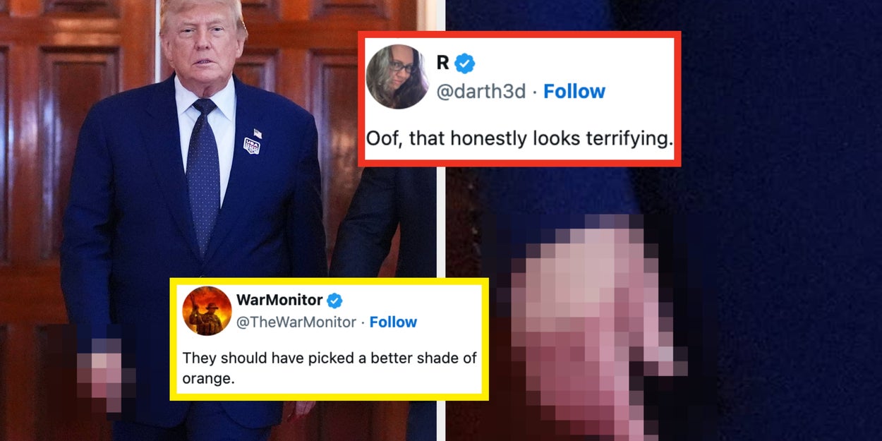 Viral Trump Hand Picture At UFC White House Fight