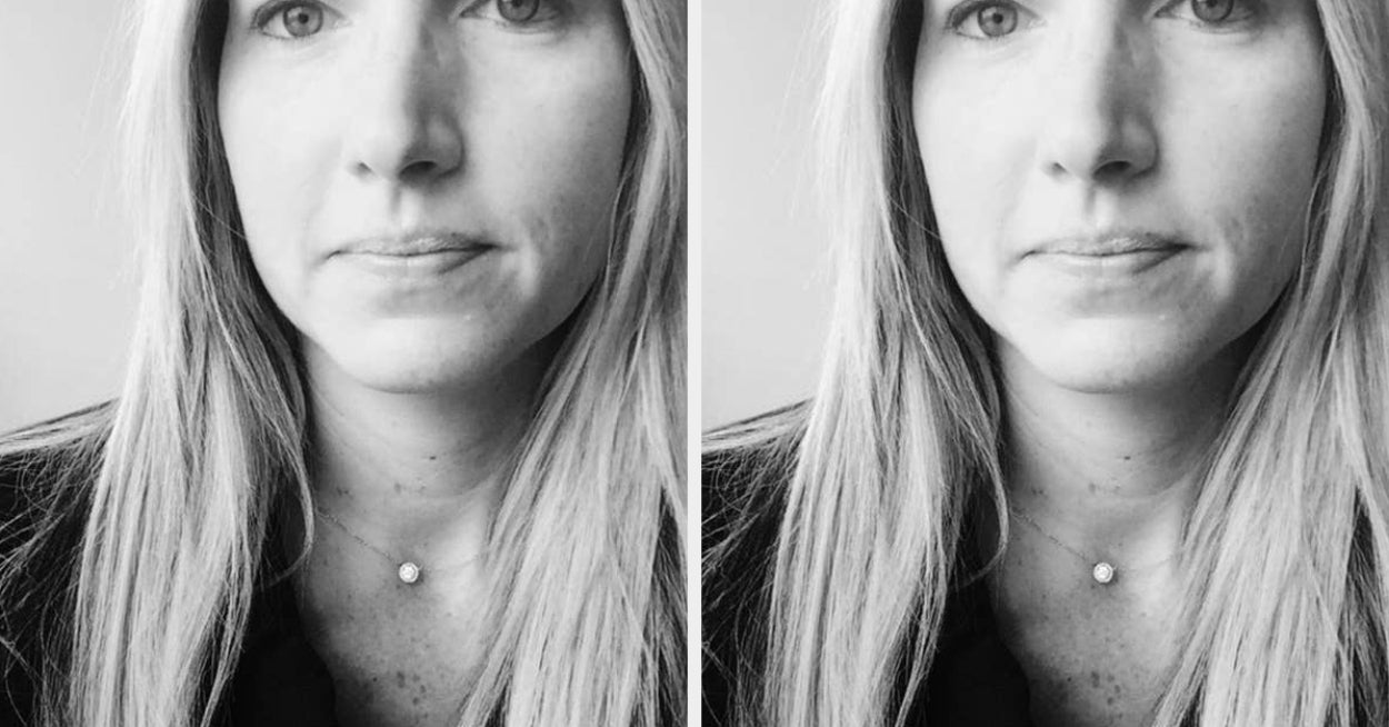 I Miscarried 4 Times In A Year. 2 Words From A Doctor Changed Everything.
