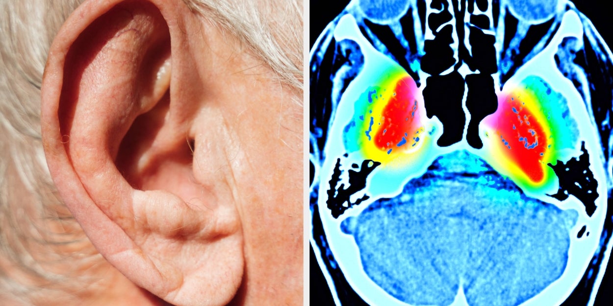 Commonly Missed Warning Signs Of Dementia