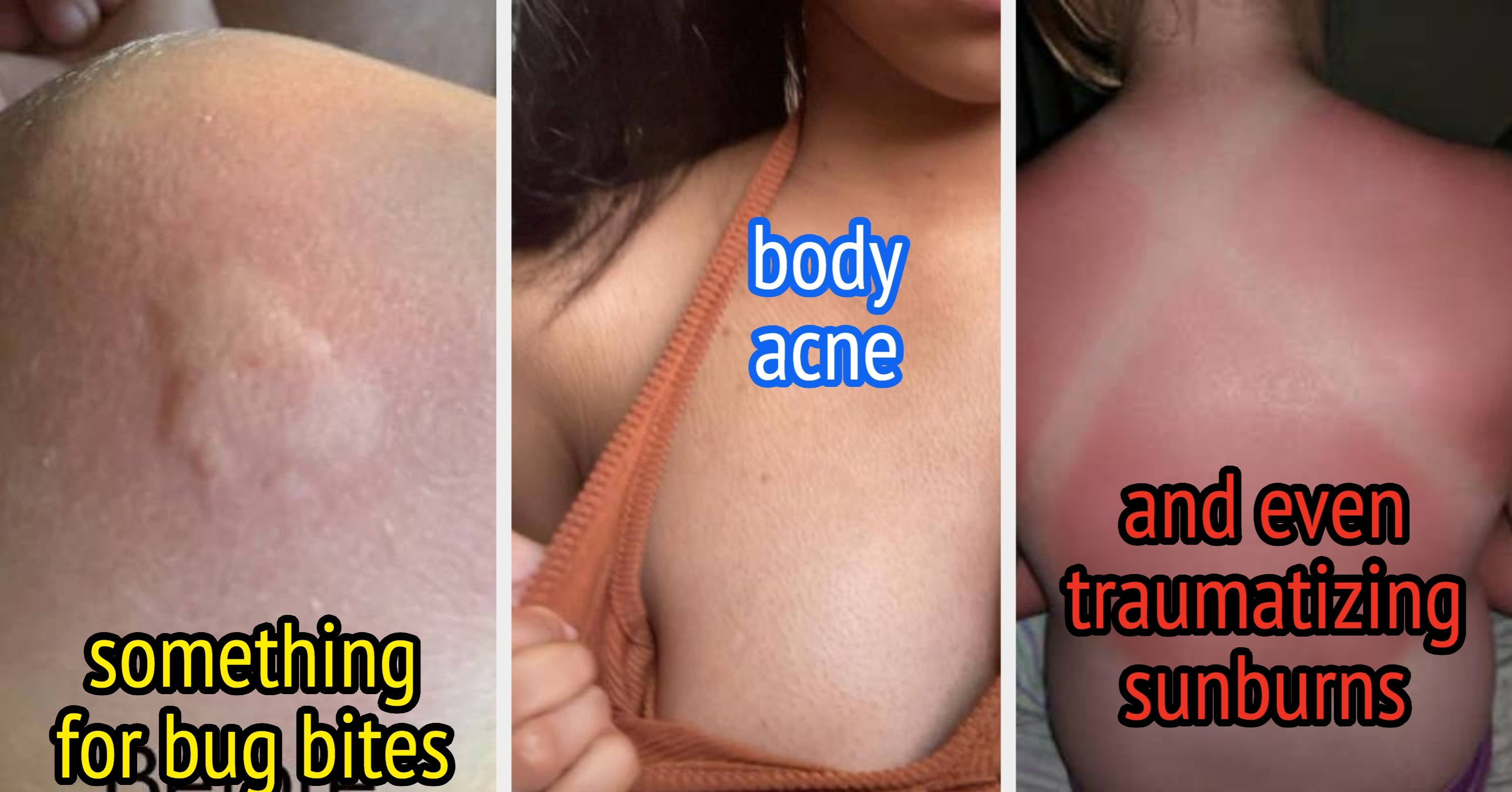 53 Personal Care Products For All Those “Ouch,” “Yuck,” Or “Ugh” Summer Body Problems