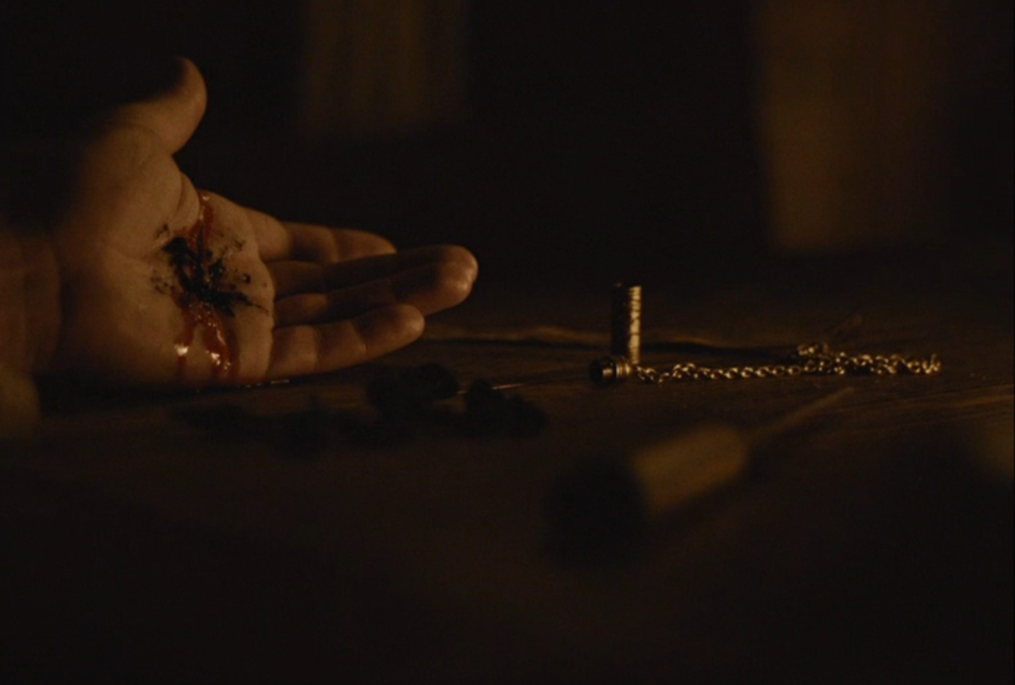 A close-up of a manus  with ungraded  and blood, lying unfastened  connected  a table. Nearby, a concatenation  and tiny  objects are visible, partially successful  shadow