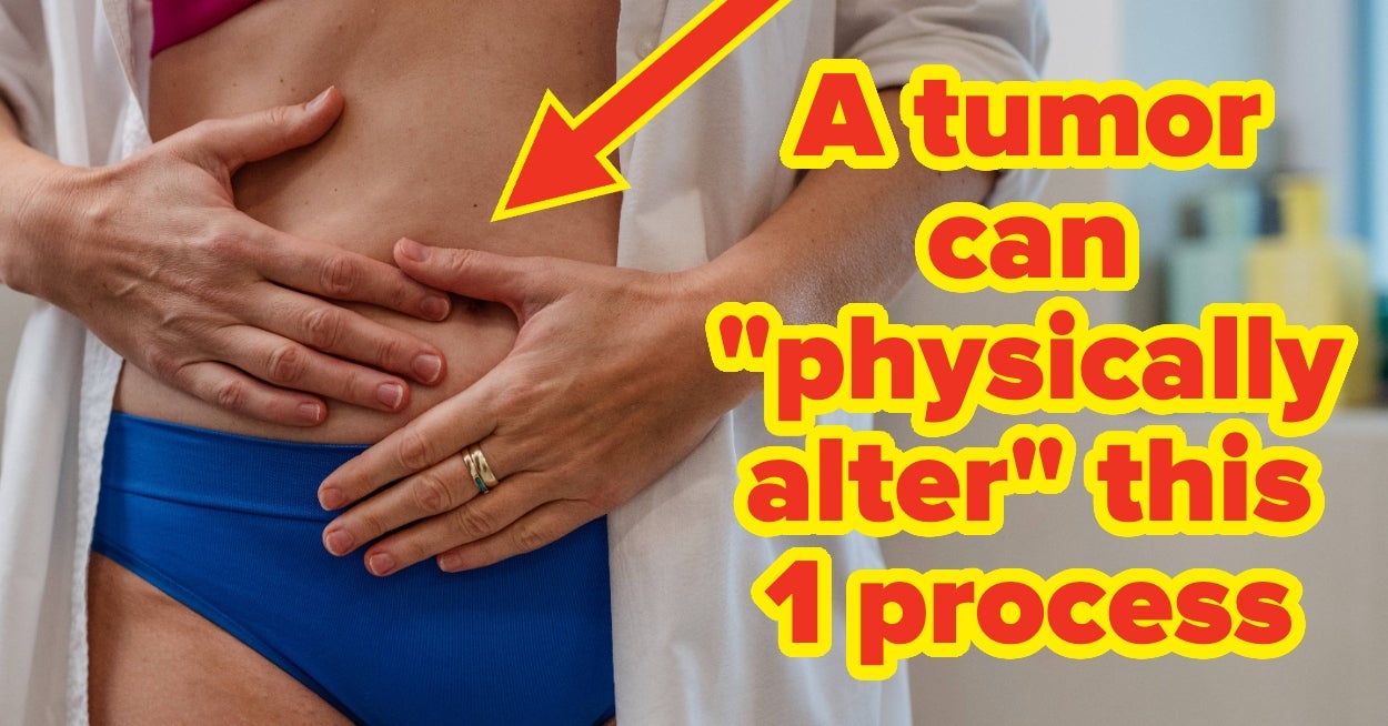 "Even If You Feel Too Young": Experts Say It's Urgent That You Pay Attention To These 5 Commonly Missed Signs Of Bowel Cancer