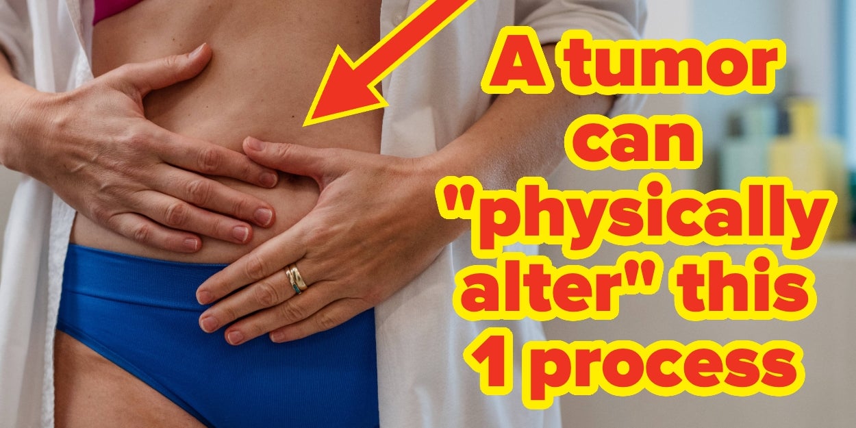 5 Commonly Missed Signs Of Bowel Cancer