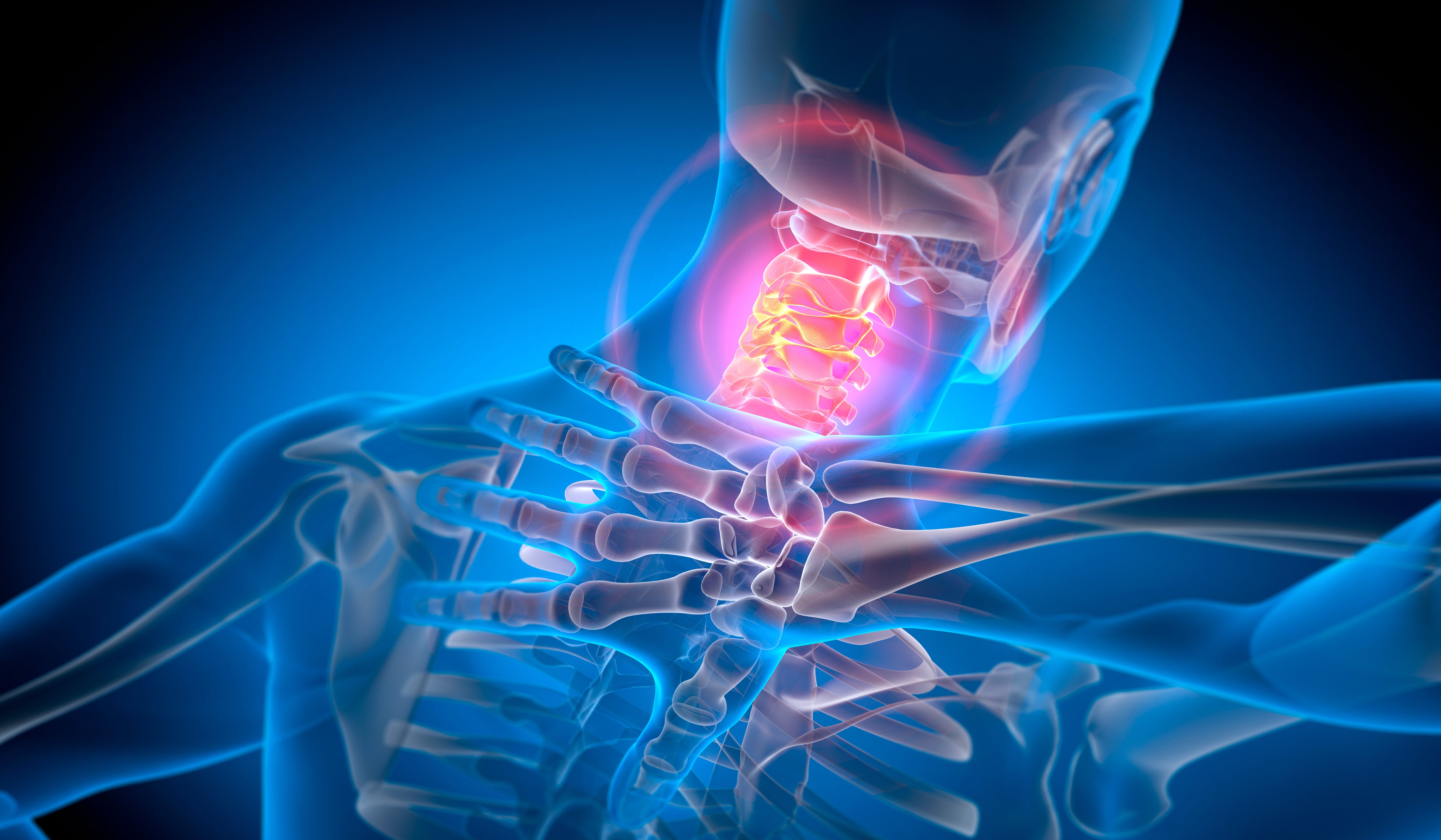 X-ray illustration of a quality skeleton's neck, highlighting the vertebrae and spinal operation with a absorption connected a symptom country successful the neck