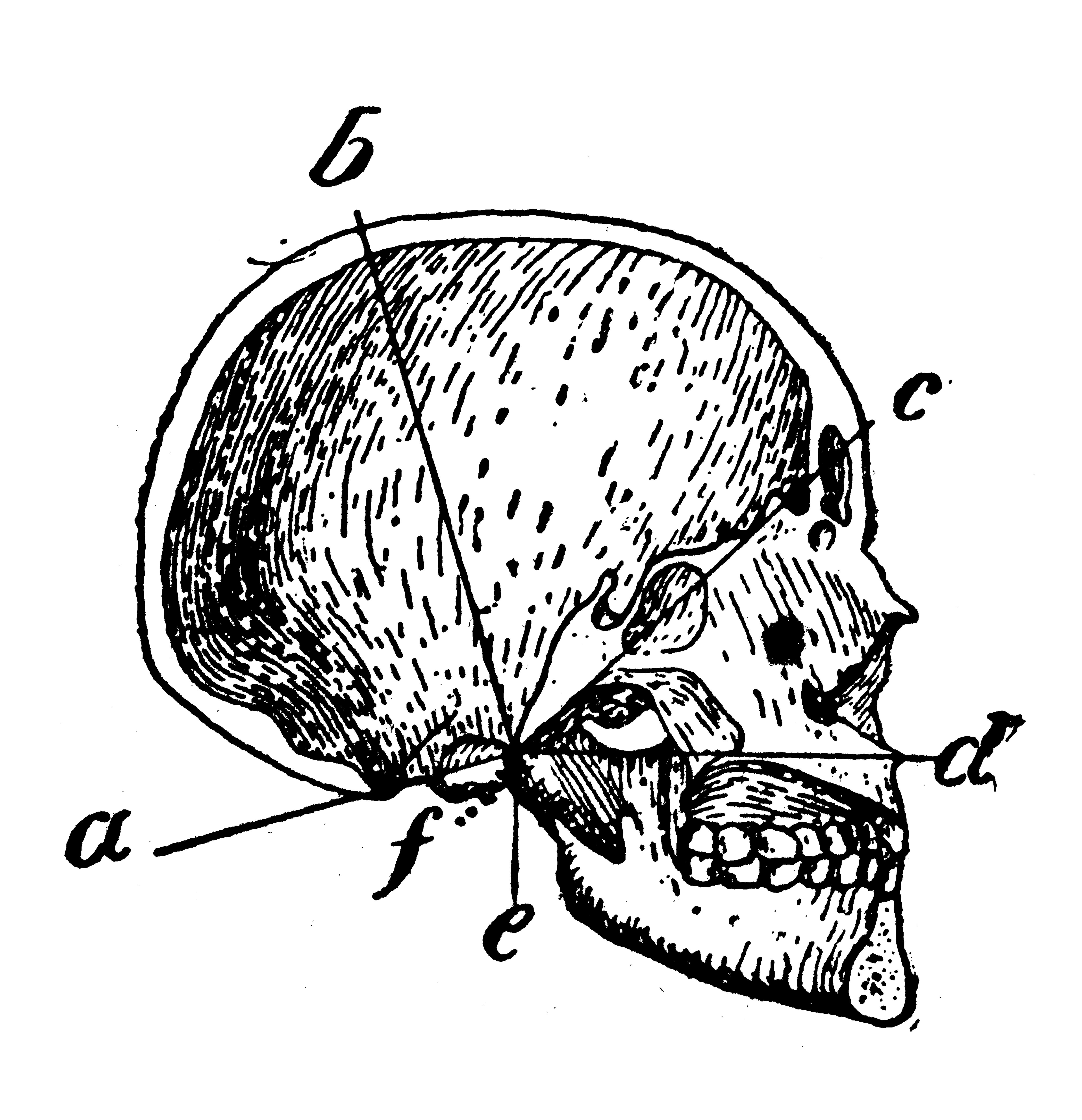 a to f. The illustration highlights assorted skull features and structure