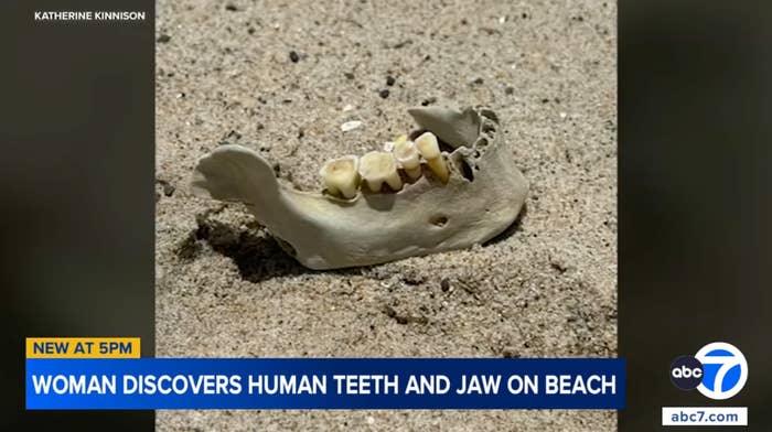  "Woman discovers quality  teeth and jaw connected  beach."