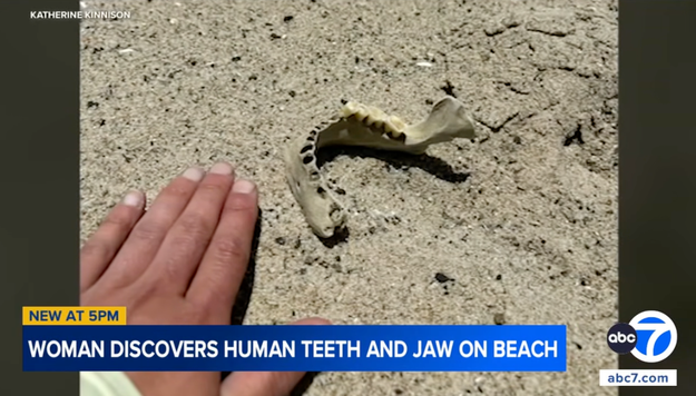 A manus  connected  soil  adjacent  to a quality  jawbone. News header  reads, "Woman discovers quality  teeth and jaw connected  beach." ABC7 logo successful  corner