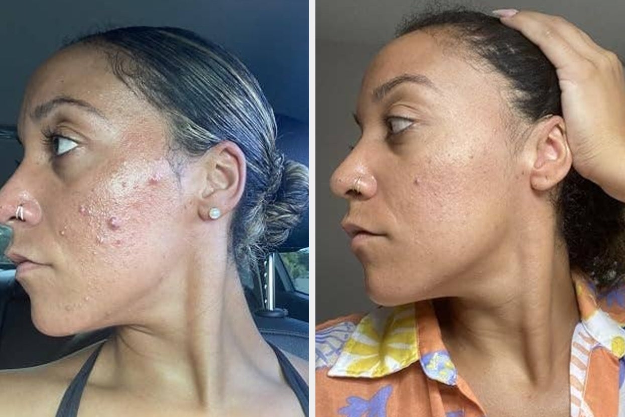 39 Skincare Products From Amazon Our Readers Are Loving In 2026