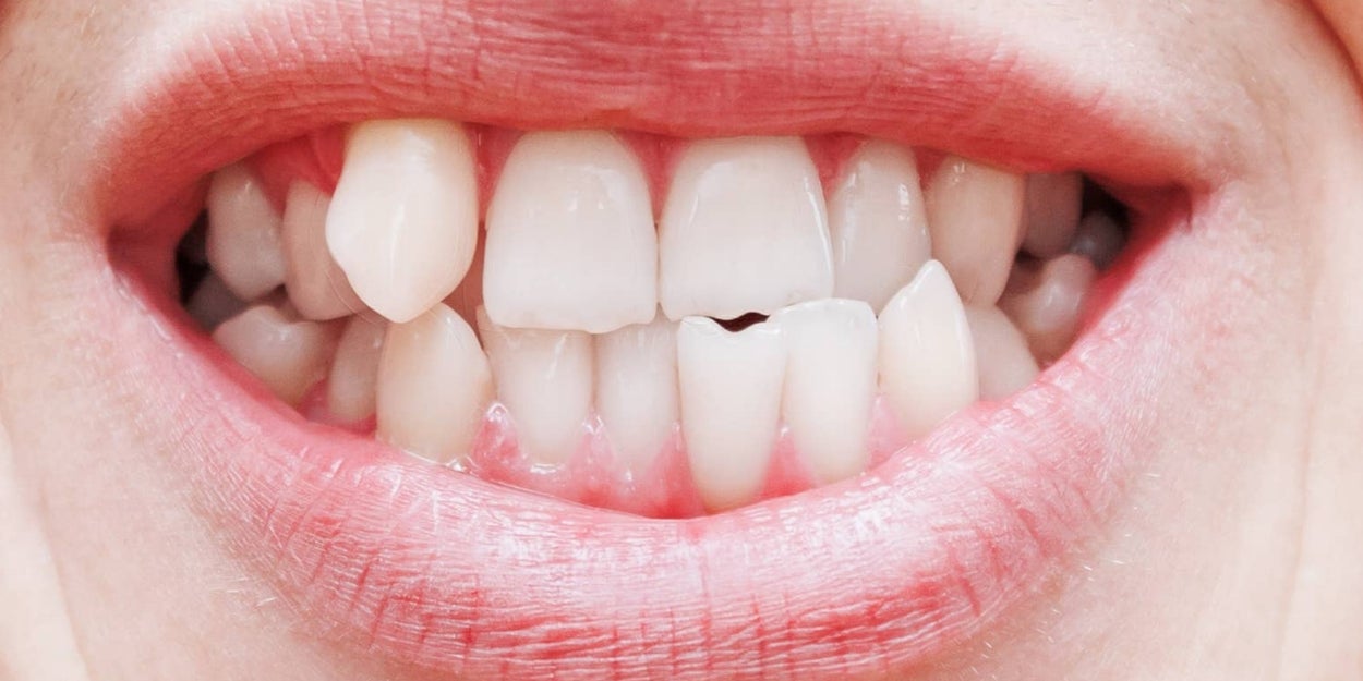People Share "Ugly" Traits They Find Attractive