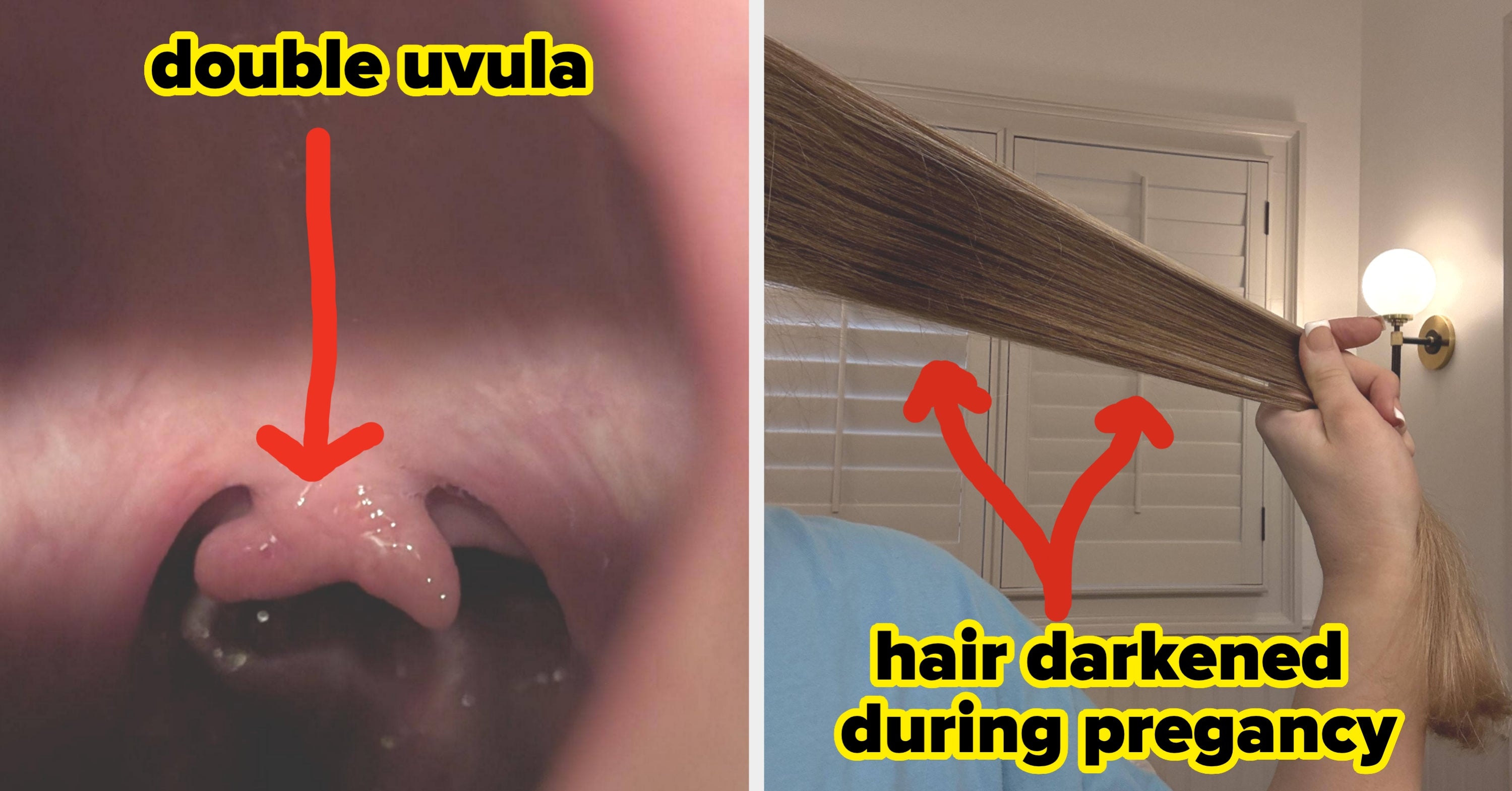 28 Jaw-Dropping Pictures Of The Human Body That Will Completely And Totally Change Your Perspective On Life