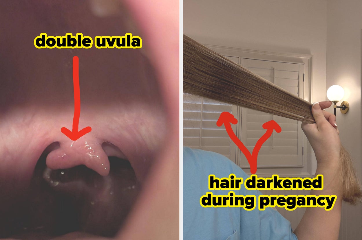 28 Jaw-Dropping Pictures Of The Human Body That Will Completely And Totally Change Your Perspective On Life