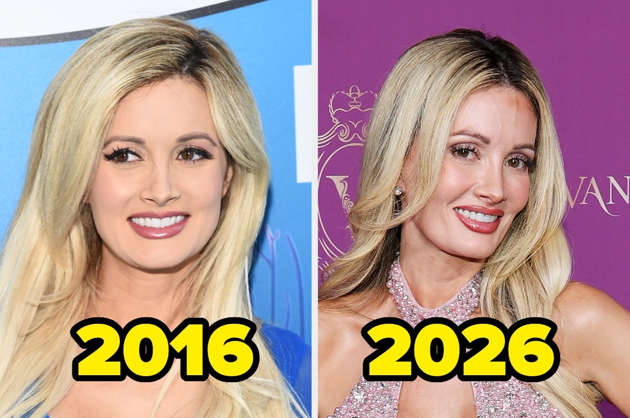 Holly Madison Just Revealed Every Cosmetic Procedure She's Had Done