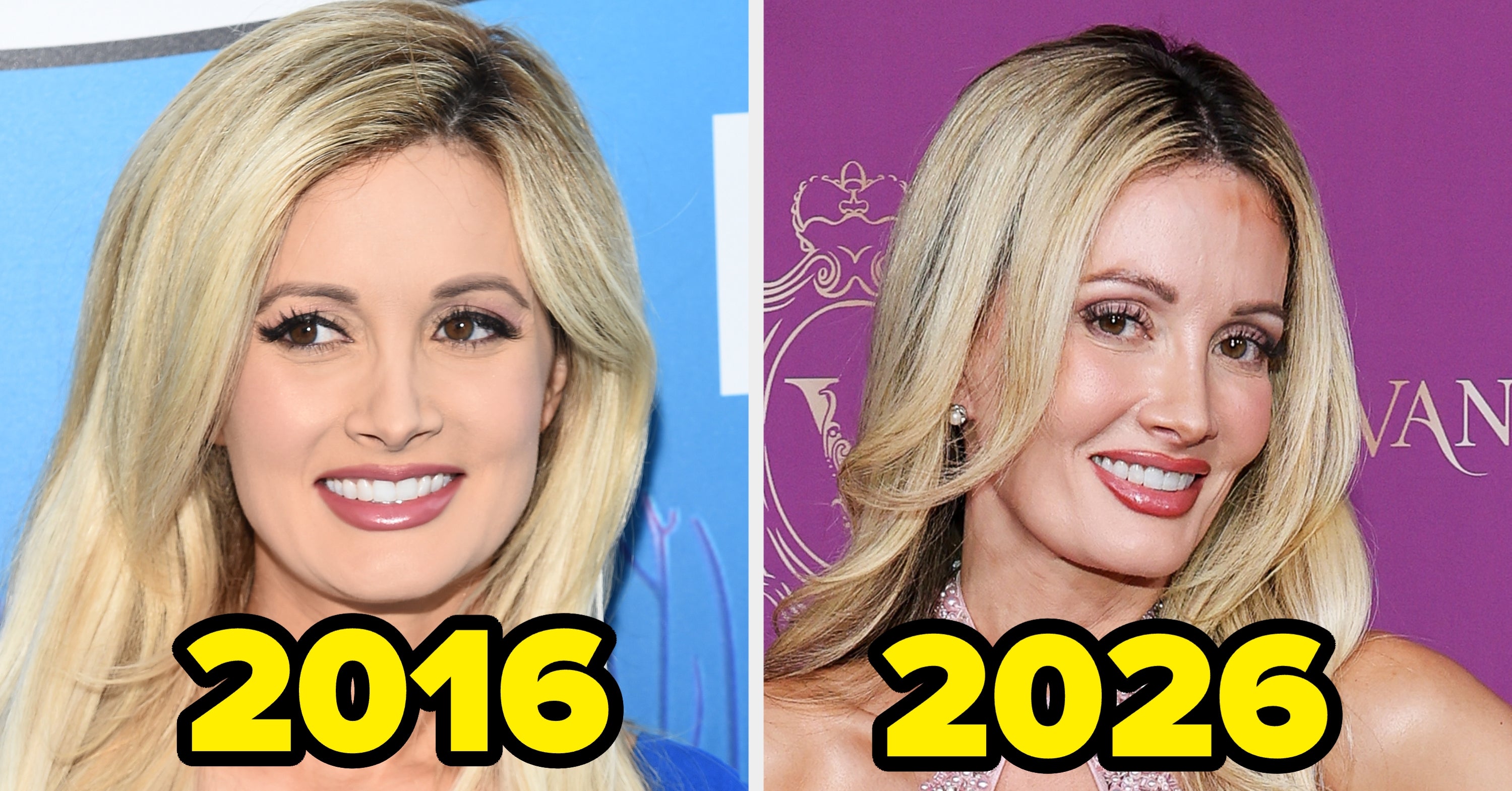 Here's Every Cosmetic Procedure That Holly Madison Says She's Had Done
