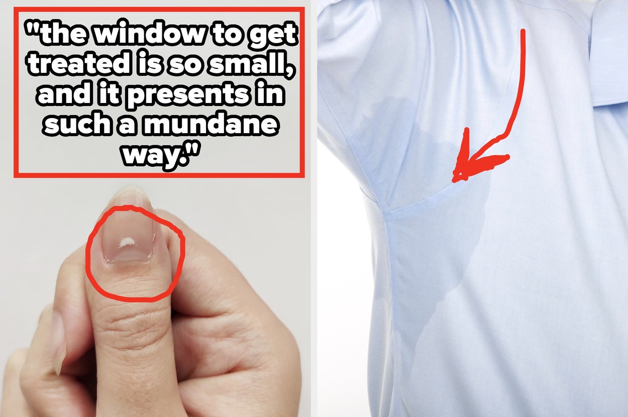 "You Are Having A Medical Emergency": 28 "Small" Symptoms That People Ignore Wayyyy Too Often, According To Doctors And Nurses