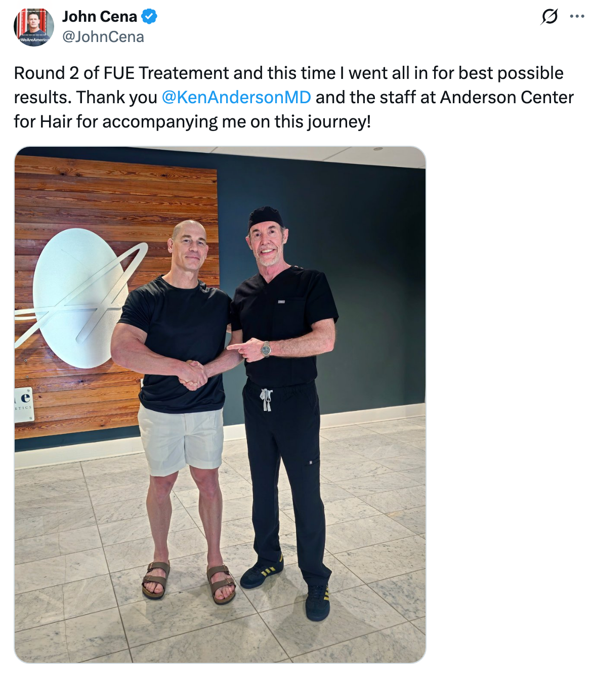 John Cena's Bald Look For Second Hair Transplant