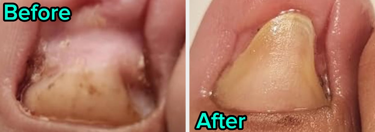 I Know You Don’t Wanna Talk About Those Kinda Embarrassing Problems *But* These 32 Products Will Help