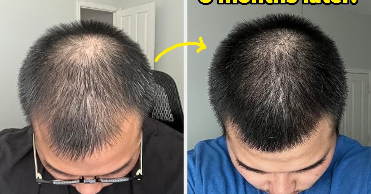 31 Products With Such Mind-Boggling Results, They'll Make You Gasp