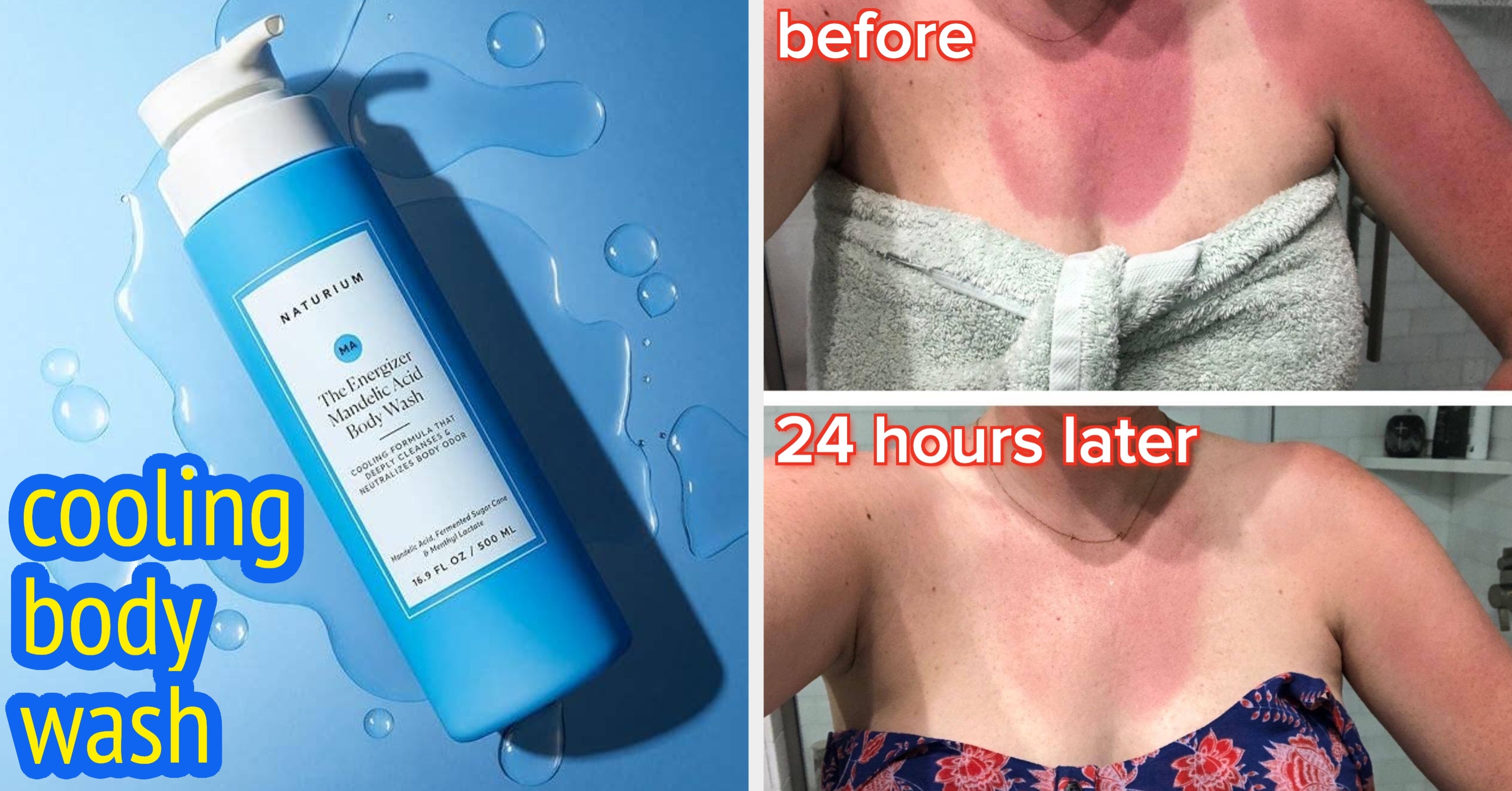 These Items Help Fix Chlorine Hair, Blisters, And 25 Other Little Body-Related Summer Problems