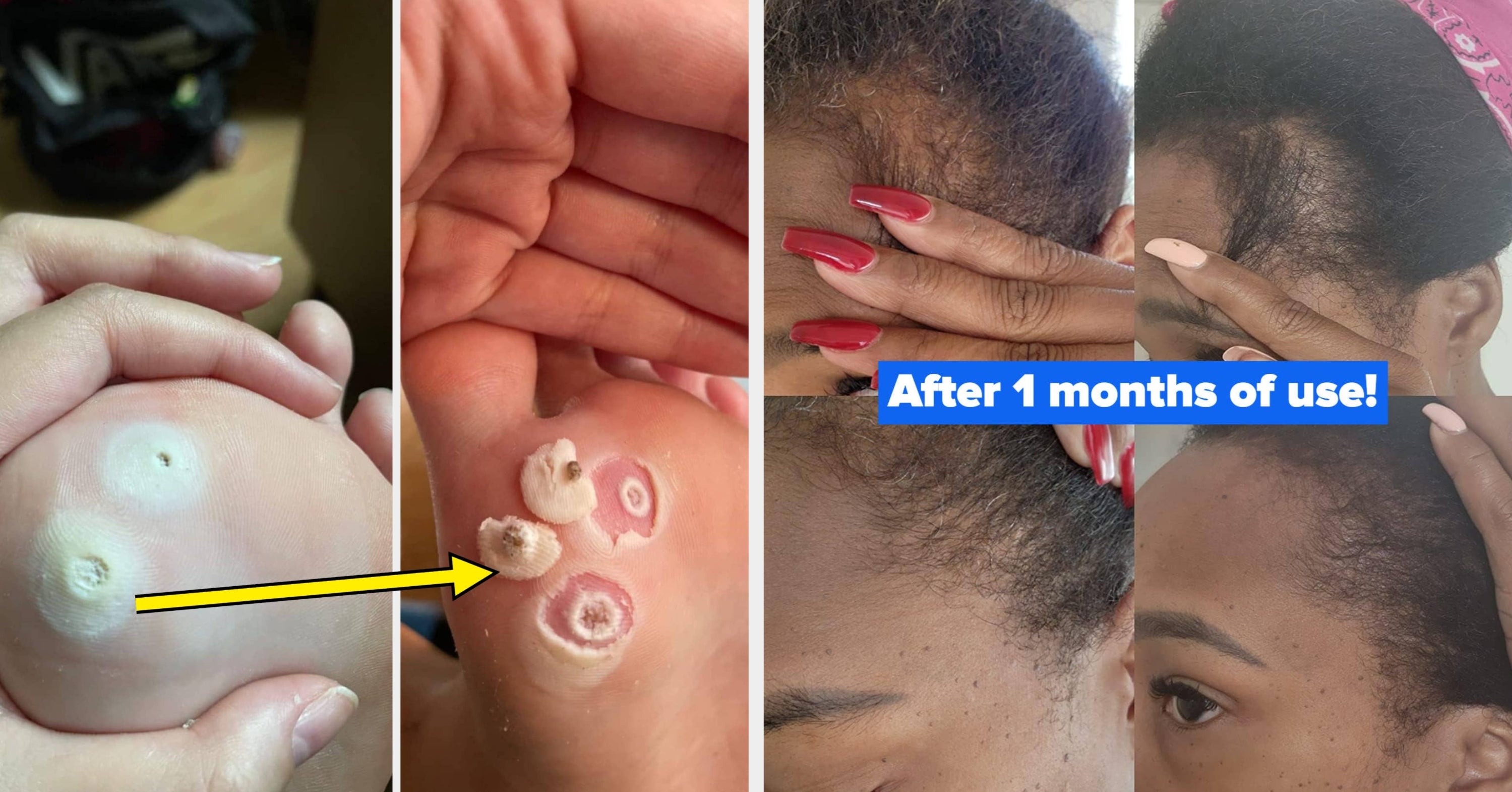 30 Personal Care Products Under $10 That Reviewers Can’t Get Enough Of
