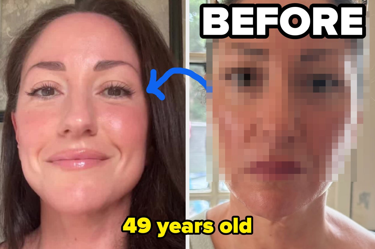 "My Face Literally Looked Like It Was Melting": This 49-Year-Old Mom Is Going Viral For Sharing Exactly What She Did To Look Decades Younger After Losing A Lot Of Weight