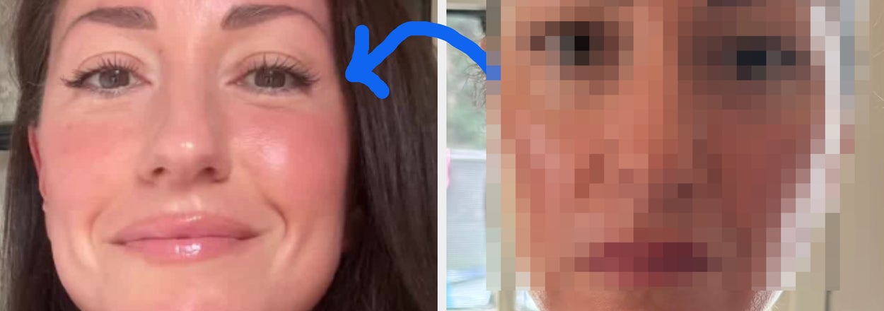"My Face Literally Looked Like It Was Melting": This 49-Year-Old Mom Is Going Viral For Sharing Exactly What She Did To Look Decades Younger After Losing A Lot Of Weight
