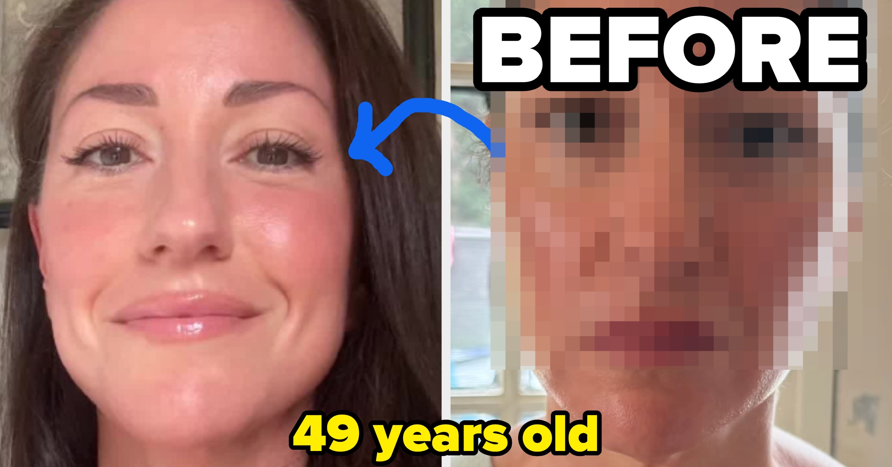 “My Face Literally Looked Like It Was Melting”: This 49-Year-Old Mom Is Going Viral For Sharing Exactly What She Did To Look Decades Younger After Losing A Lot Of Weight