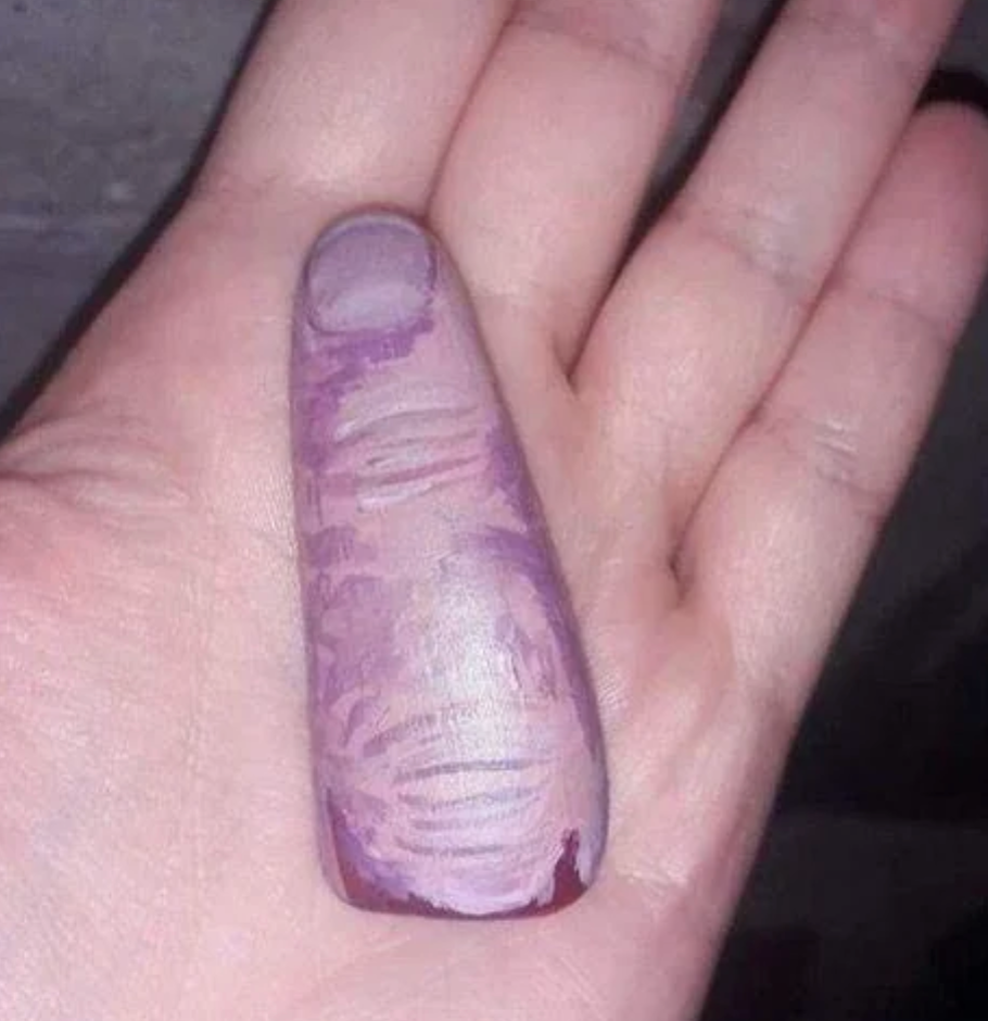 Hand with realistic digit drafting connected thumb, creating an illusion of 2 thumbs