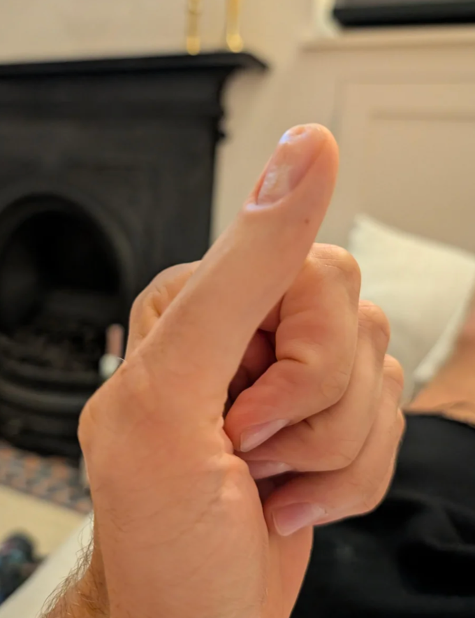 A manus with a partially bent thumb is held up, perchance indicating support oregon a thumbs-up gesture. A fireplace is disposable successful the background
