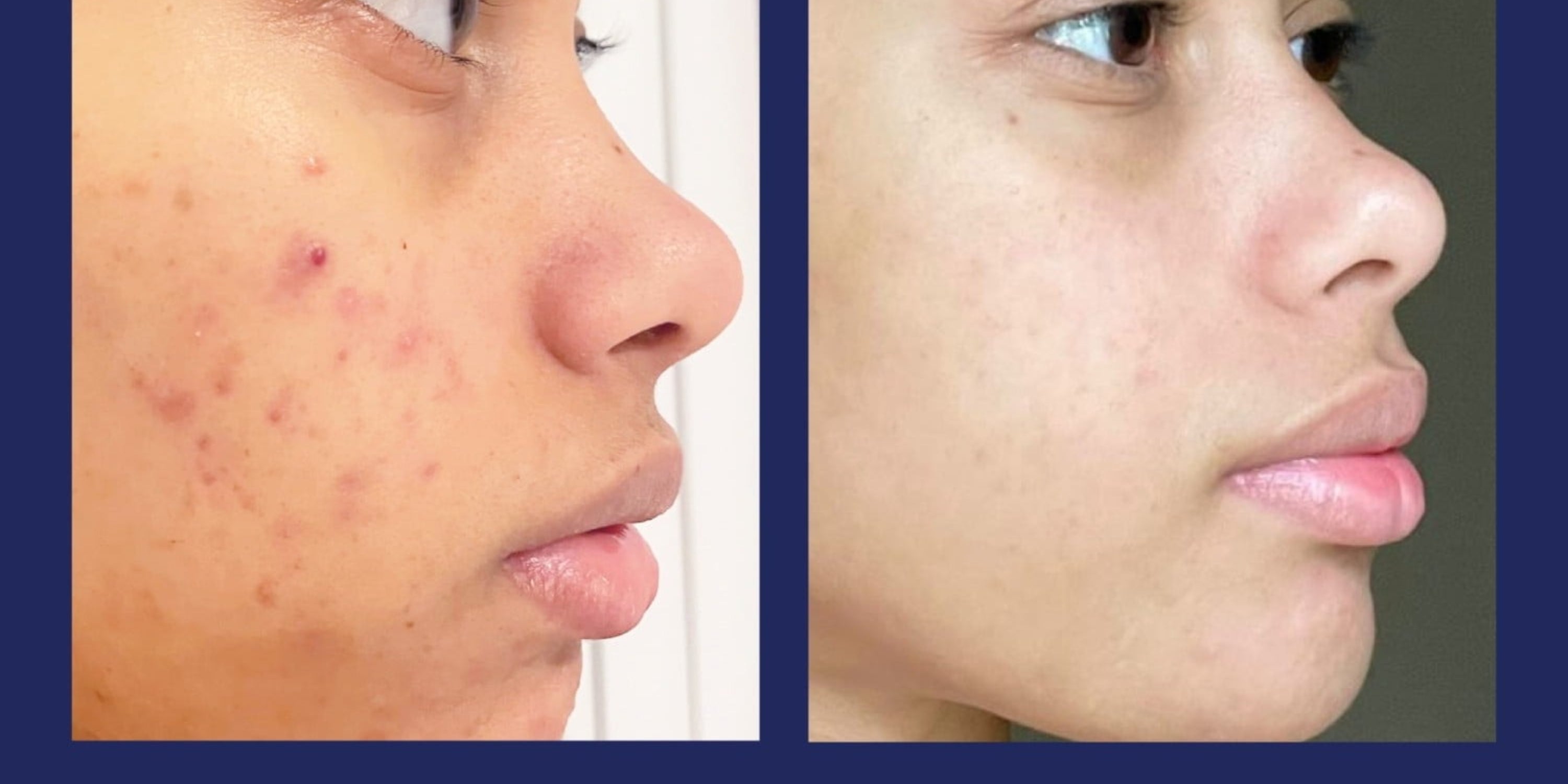 27 Walmart Skincare Products That Deserve A Permanent Place In Your Cabinet