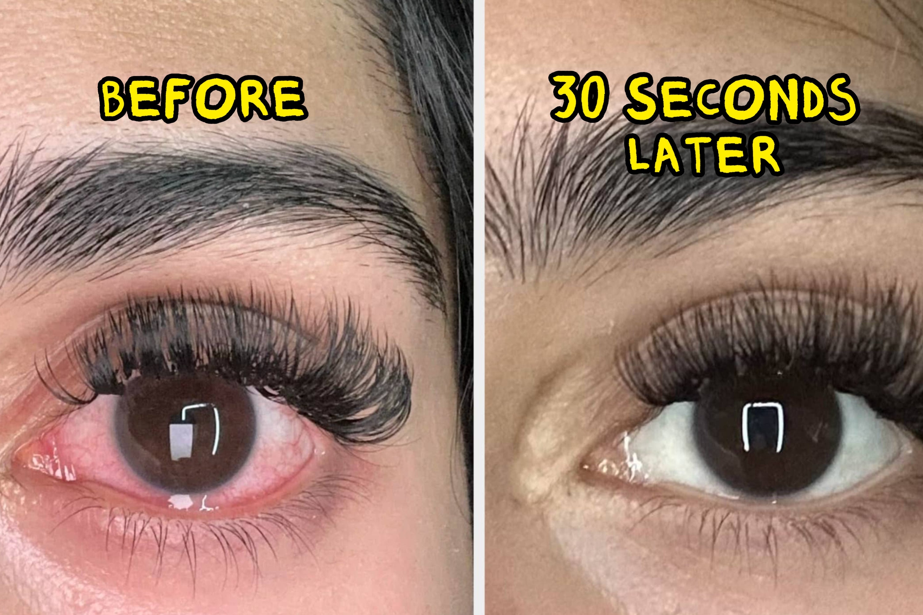 Close-up of an eye before and after relief, showing reduced redness and clearer, brighter appearance 30 seconds later