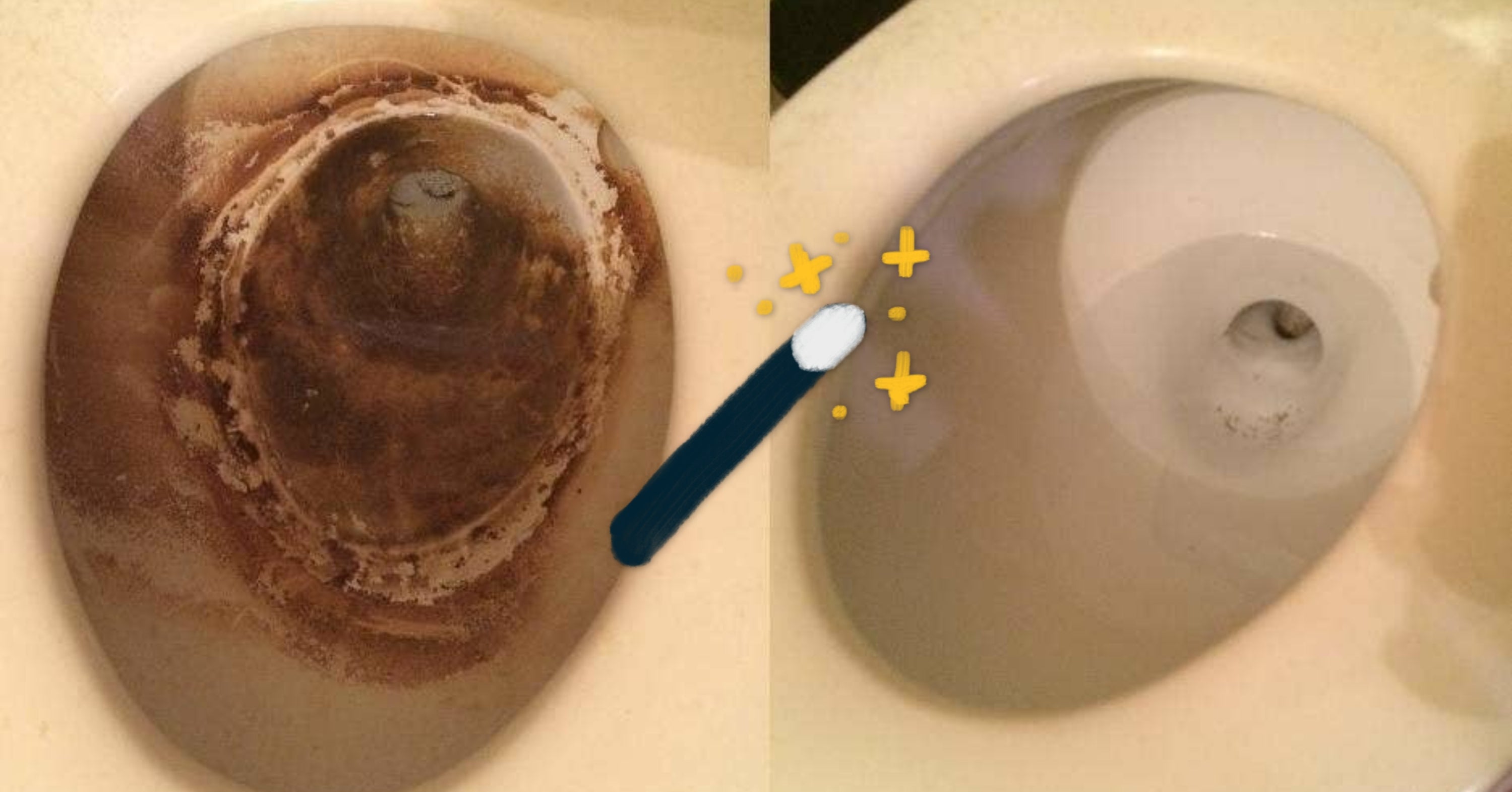 10 Somewhat Embarrassing Problems And 10 Products To Solve Them